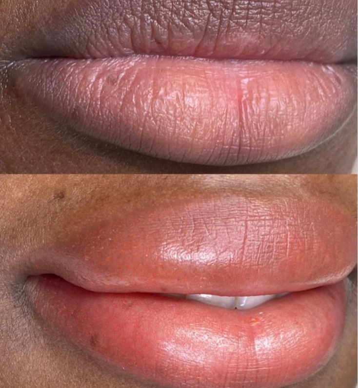 Pigmentation lèvres — Beauty Sam Academy